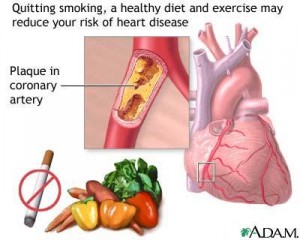 Natural Home Remedies for Coronary Heart Disease
