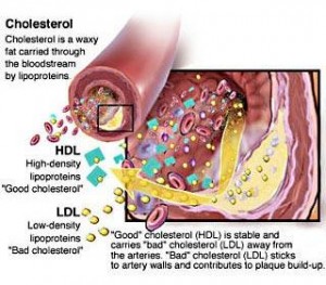 How To Reduce Cholesterol Naturally